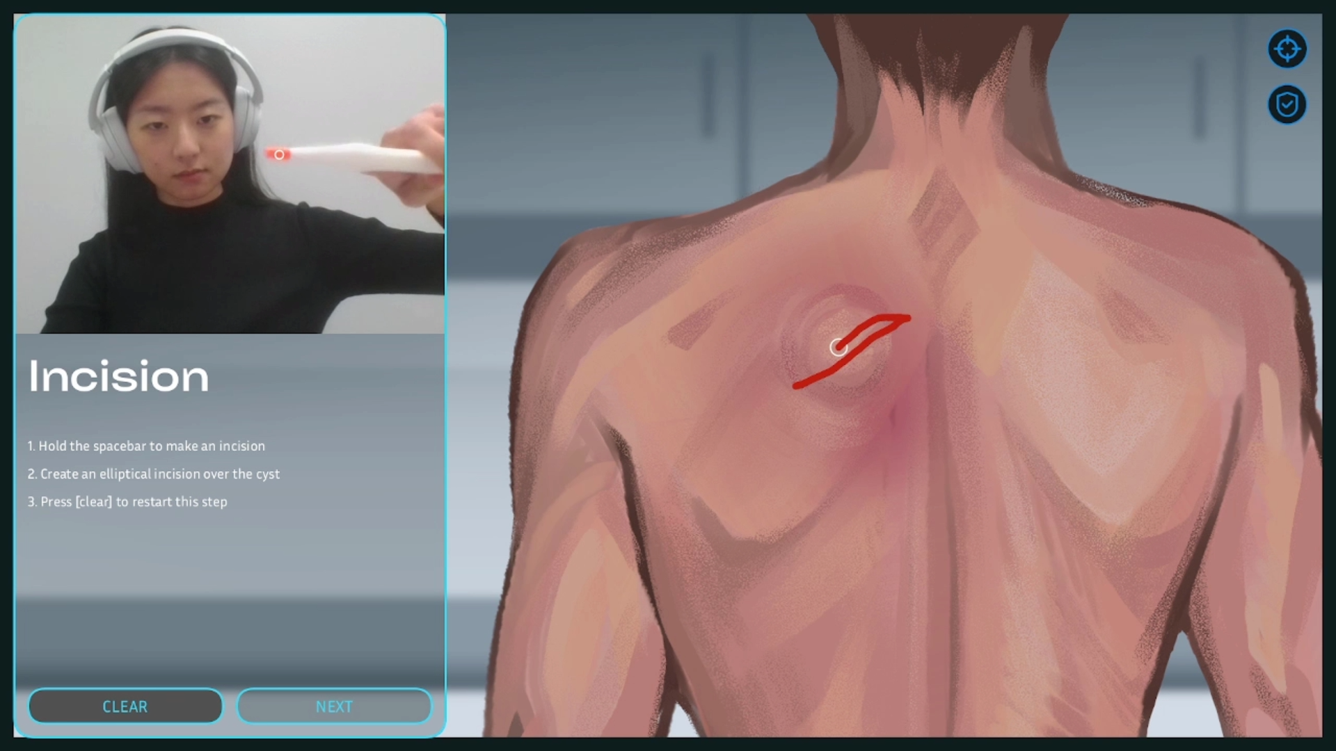 Surgical simulation screenshot